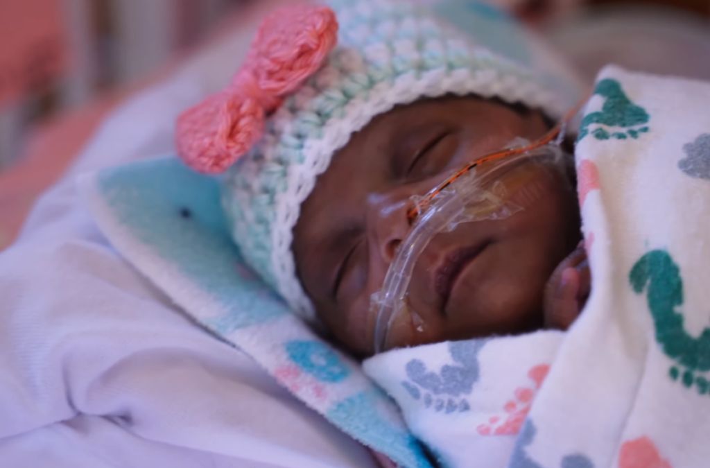 LUTH Successful Performs First Minimal Surgery On 13-Day-Old Baby